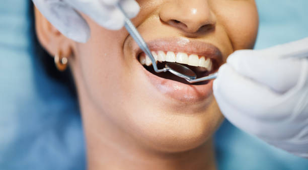 Best Emergency Tooth Extraction in Botkins, OH